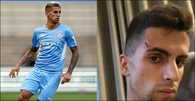 ডাকাতির শিকার সিটি তারকা ক্যানসেলো